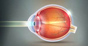 Understanding The 4 Refractive Errors – West Metro Ophthalmology MN